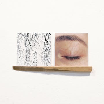 Dendrite