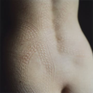 Imprint